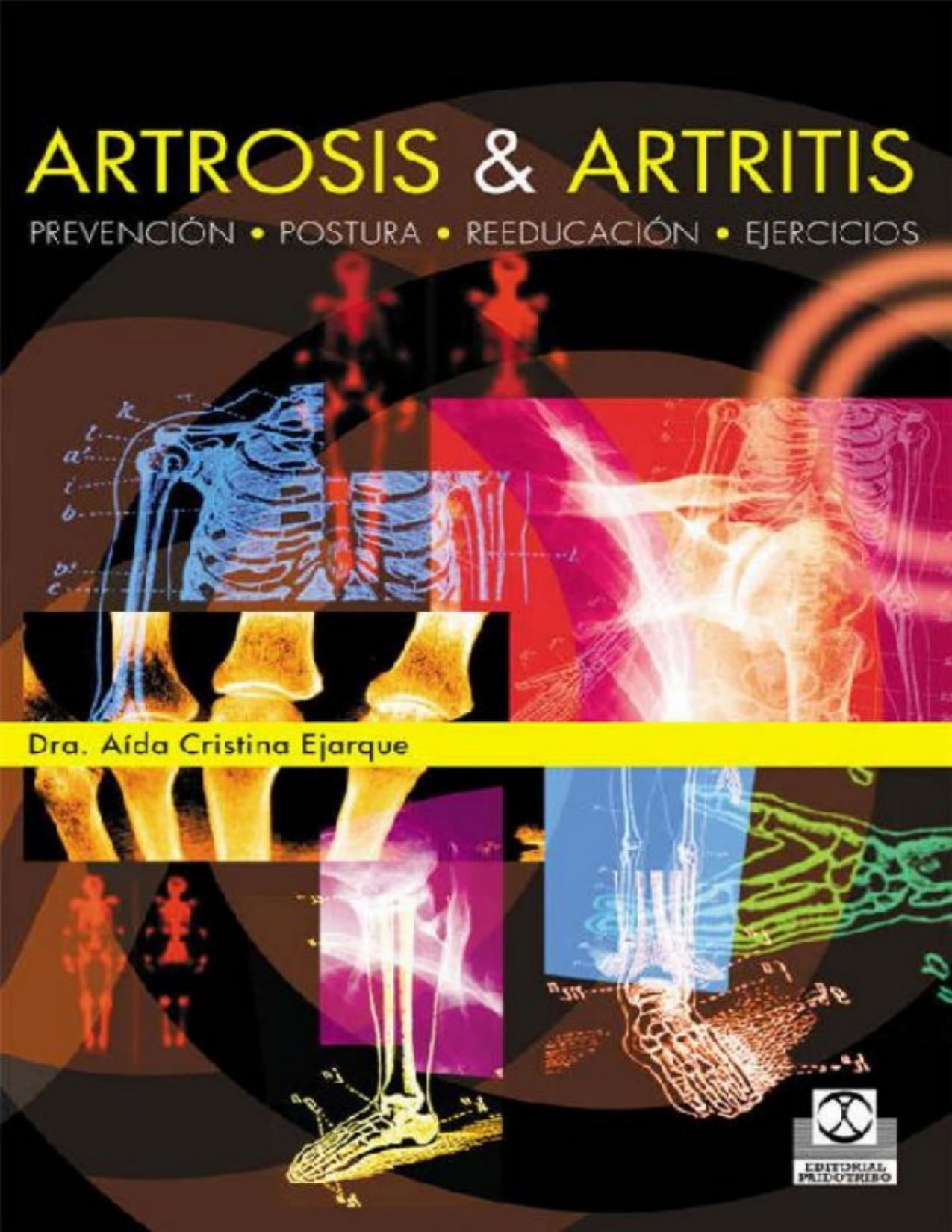 Artrosis & artritis de Aida Cristina Ejarque, portada del libro