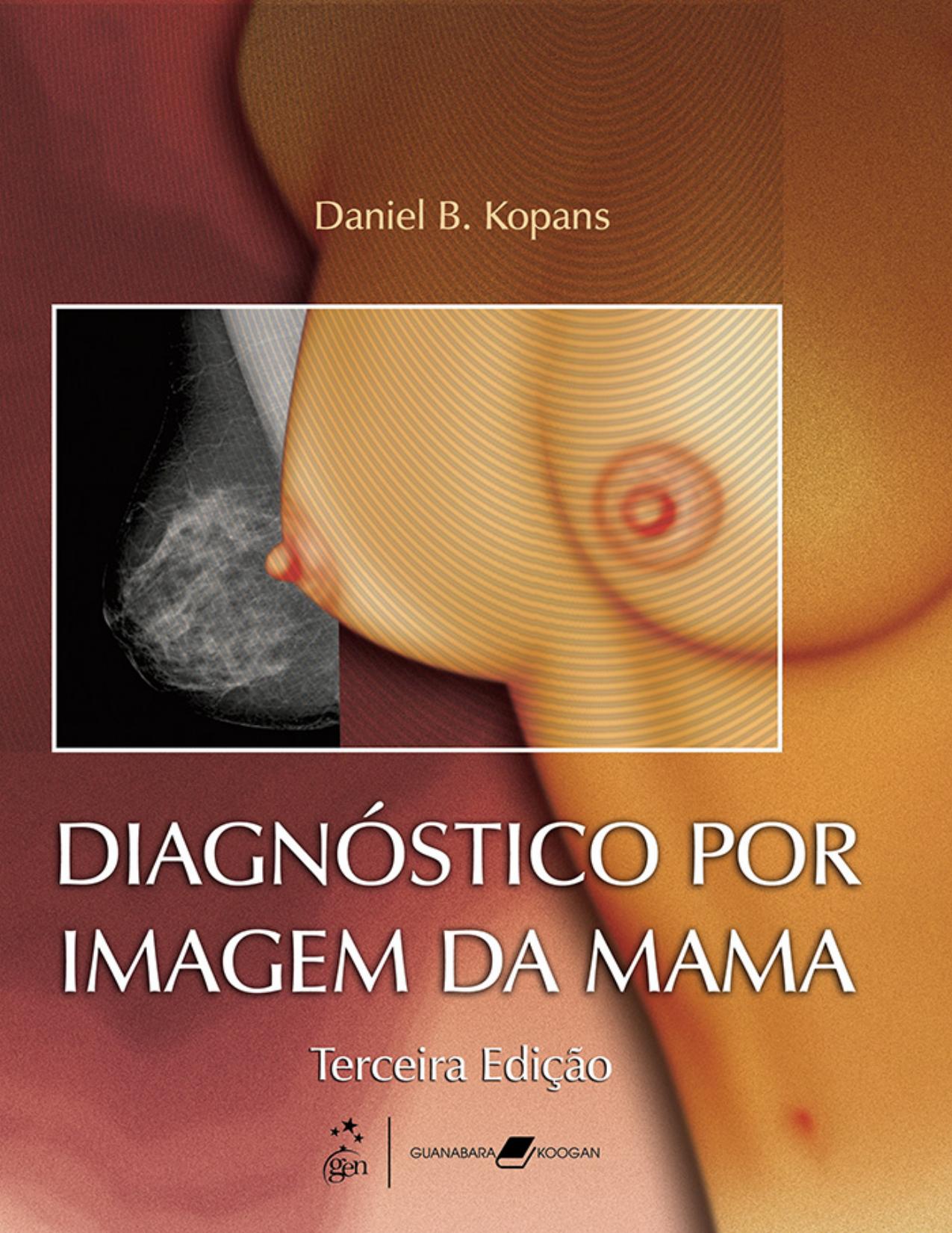 Diagnostico Por Imagem Da Mama 3a Edicao 2391