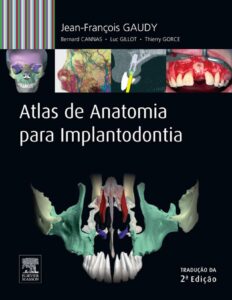 Atlas de Anatomia para Implantodontia by Jean-François Gaudy, Bernard Cannas, Luc Gillot, Thierry Gorce, book cover