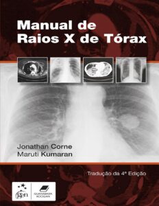Manual de Raios X de Tórax by Jonathan Corne e Maruti Kumaran, book cover