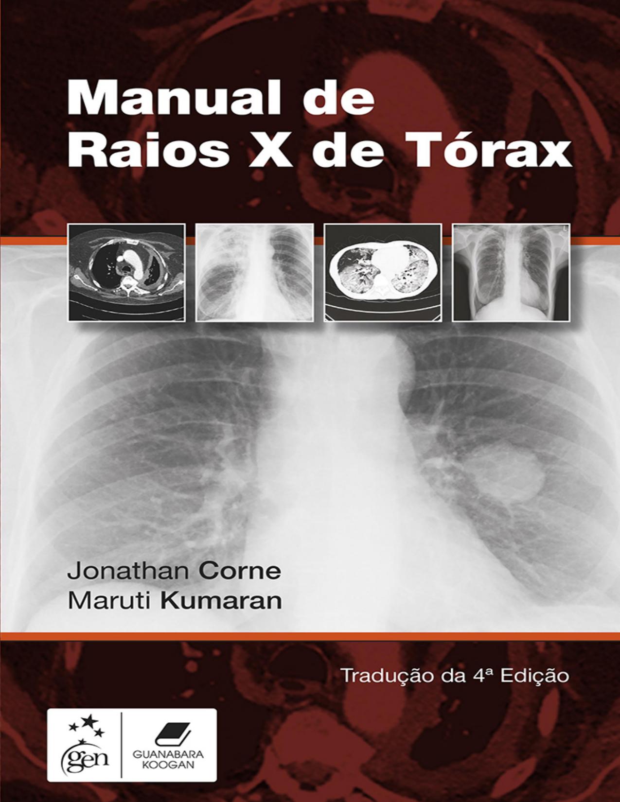 Capa do livro Manual de Raios X de Tórax, de Jonathan Corne e Maruti Kumaran